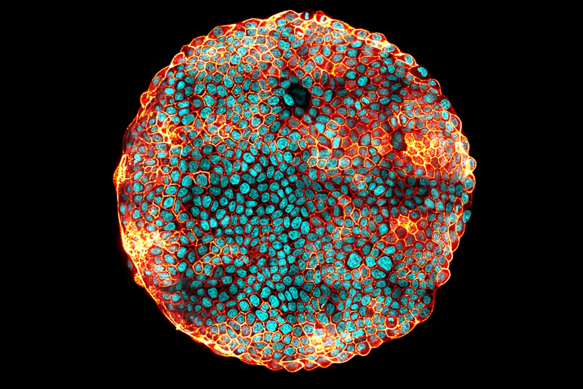 Circular island of MDCK epithelial cells imaged by confocal fluorescence microscopy: nuclei in cyan, cell junctions outlined in red and orange